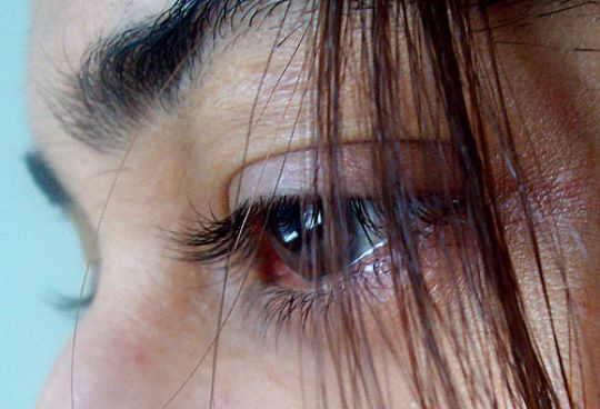 Fibromyalgie - Quelle: Samiksha Kanchankar, CC BY 2.0 (http://www.flickr.com/photos/samiksha/435477163/)